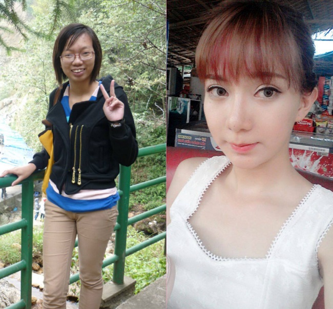 Cuối cùng là một cô gái đến từ Nam Định khác, tên Lưu Tuyết Nhung cũng "hóa thiên nga" nhờ phẫu thuật thẩm mỹ. 