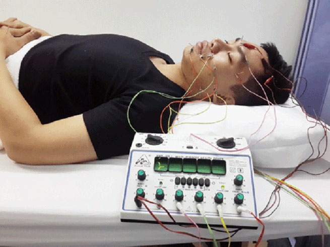 Méo miệng, liệt mặt vì điều hòa - 2