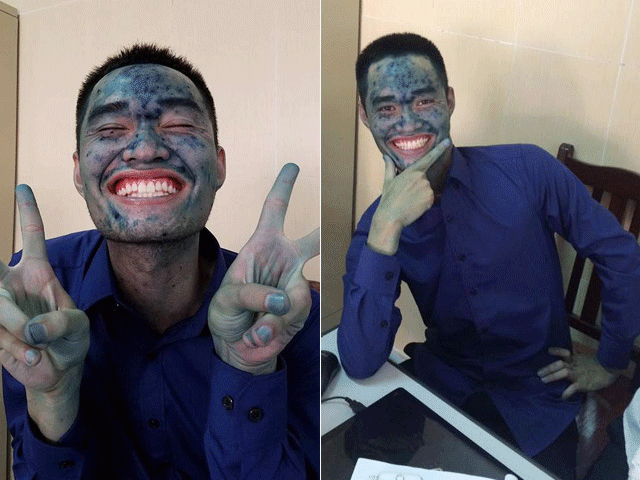 Nam sinh trường Mỏ mang khuôn mặt “xanh lét” đi bảo vệ tốt nghiệp