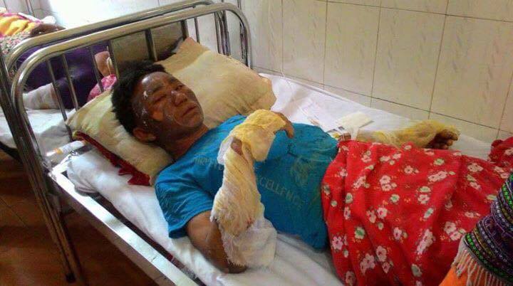 Nóng 24h qua: Lao công bị đánh bất tỉnh vì nhắc nhở đổ rác đúng chỗ - 4