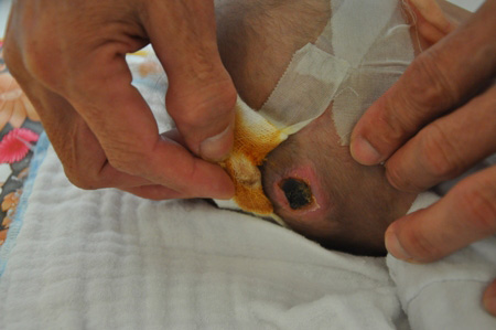 Nguy hiểm chết người chỉ vì chiếc gai bưởi - 1