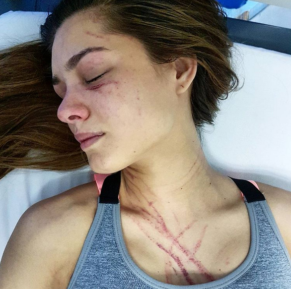 Hỗn chiến hoa hậu Venezuela bị nữ ca sĩ đánh trọng thương - 1