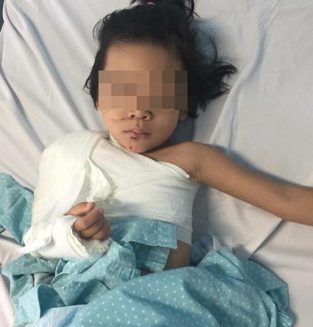 Nối thành công cánh tay bé gái 5 tuổi bị dập nát sau tai nạn giao thông - 1