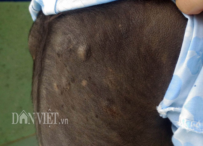 Bé gái 5 tuổi mọc lông đầy mình ở Cà Mau: "Con ngứa và đau lắm" - 2