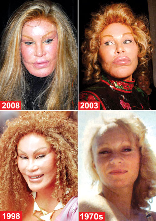 Giải mã "bệnh"nghiện làm đẹp - 2