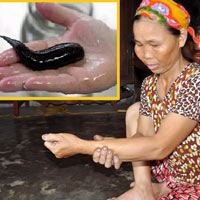 Tin tức trong ngày - Khó tin chuyện một phụ nữ “đẻ” ra đỉa