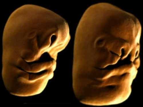 Quá trình hình thành khuôn mặt bé trong bụng mẹ - 1