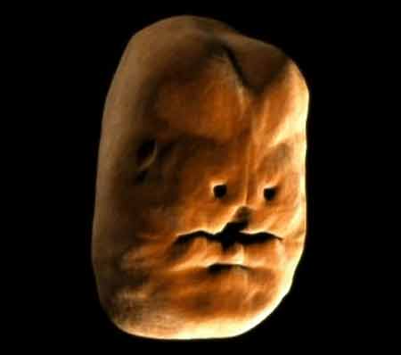 Quá trình hình thành khuôn mặt bé trong bụng mẹ - 2