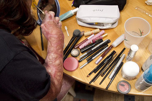 Nơi gặp gỡ của những cô gái bị bỏng mặt - 6