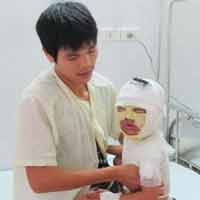Sức khỏe đời sống - Phỏng 2 lần vì sơ cứu sai