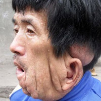 Tin tức trong ngày - Người đàn ông có khuôn mặt "tan chảy" ở TQ