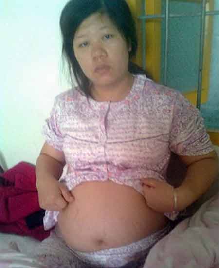 Thai phụ bị ép phá thai 7 tháng - 1
