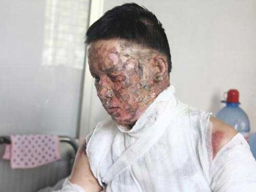 Những ca cấp cứu "nhạy cảm" - 2