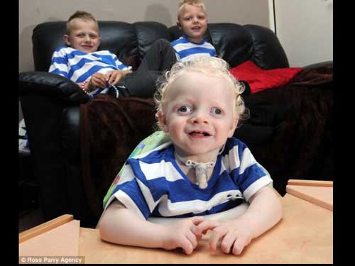 Bệnh lạ: Cậu bé không bao giờ ngủ - 2