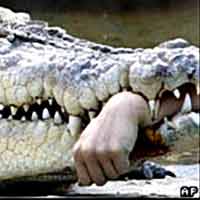 Sức khỏe đời sống - Một phụ nữ bị cá sấu cắn đứt cánh tay