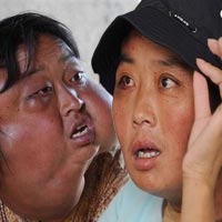Phi thường - kỳ quặc - &quot;Giải cứu&quot; bà mẹ có khối u khổng lồ