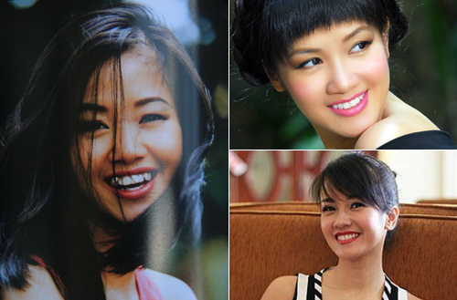 Răng khểnh dễ thương của giai nhân Việt - 2