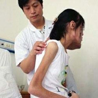 Tin tức trong ngày - Nữ sinh TQ gầy như "ma đói" vì áp lực thi cử
