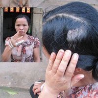 Tin tức trong ngày - Chủ tịch xã đánh hàng xóm ngất xỉu