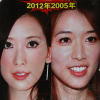  - Khuôn mặt "biến dạng" của Lâm Chí Linh