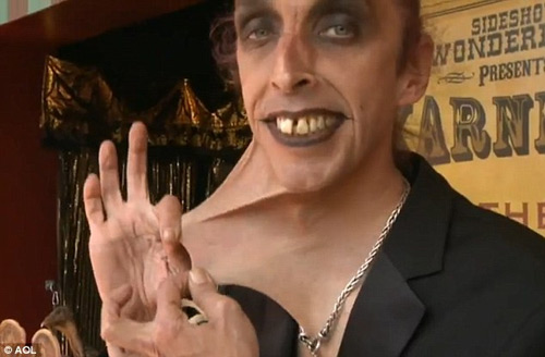 Anh: Người có làn da co giãn như cao su - 2