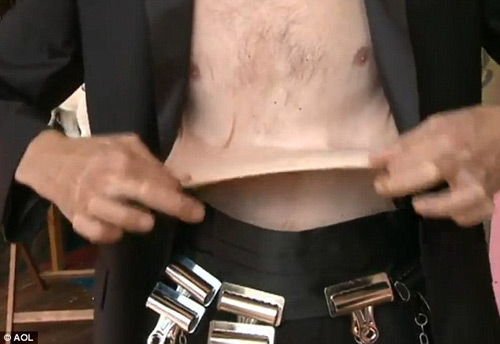 Anh: Người có làn da co giãn như cao su - 3