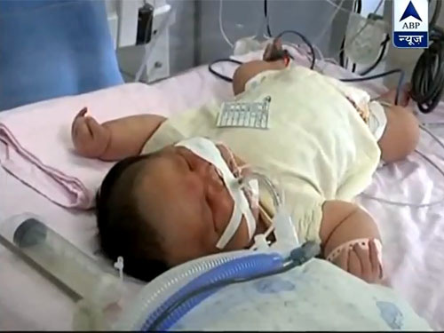 Trung Quốc: Sản phụ sinh con nặng 7,1kg - 1