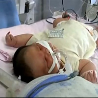 Tin tức trong ngày - Trung Quốc: Sản phụ sinh con nặng 7,1kg