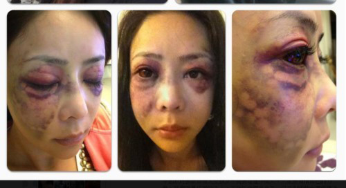 Clip người mẫu Đài Loan bị hành hung - 2