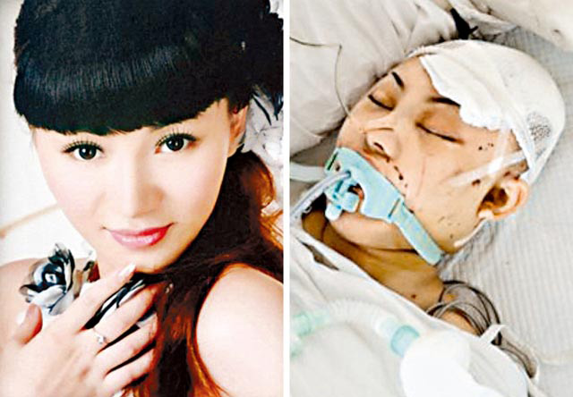 Người mẫu bị đánh vì không biết tự vệ? - 5