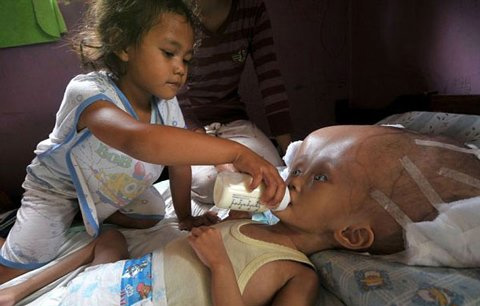 Cô bé "ngoài hành tinh" đang nguy kịch - 1