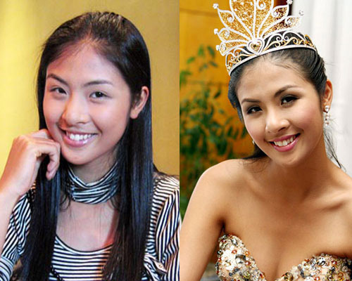 Tổng hợp khuyết điểm của người đẹp Việt - 12