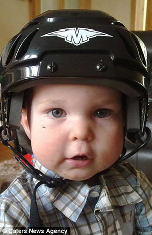 Cậu bé bị bổ đôi hộp sọ sống sót kỳ diệu - 1