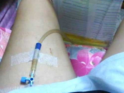 Hãi hùng tiêm nước tiểu vào người để giảm cân - 3