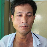 Tin tức trong ngày - Bí thư xã đánh người gãy xương hàm