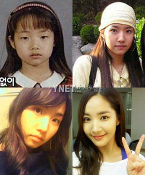 Vạch tìm vết tích dao kéo của sao Hàn - 2