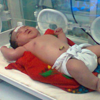 Tin tức trong ngày - Bé sơ sinh "khủng" nặng 5,3kg