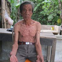 Phi thường - kỳ quặc - Người đàn ông "bong bóng" ở Quảng Nam