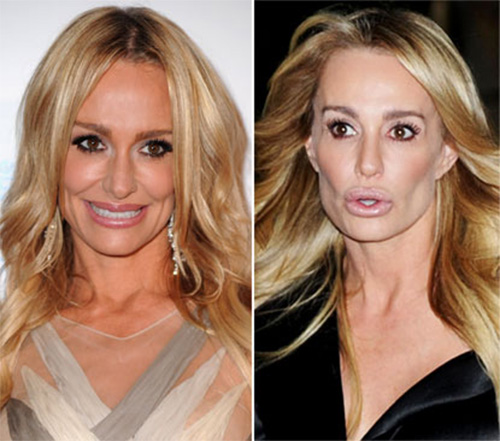 "Phong trào" bơm môi của sao Hollywood - 12