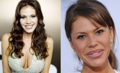 "Phong trào" bơm môi của sao Hollywood - 6