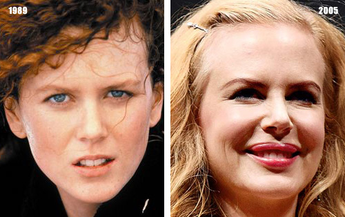 "Phong trào" bơm môi của sao Hollywood - 14