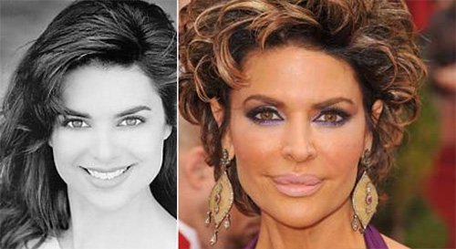 "Phong trào" bơm môi của sao Hollywood - 7