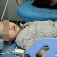 Sức khỏe đời sống - Trẻ bị cá lạ cắn đứt lìa "của quý"