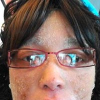 Phi thường - kỳ quặc - Cô gái mọc móng tay khắp người