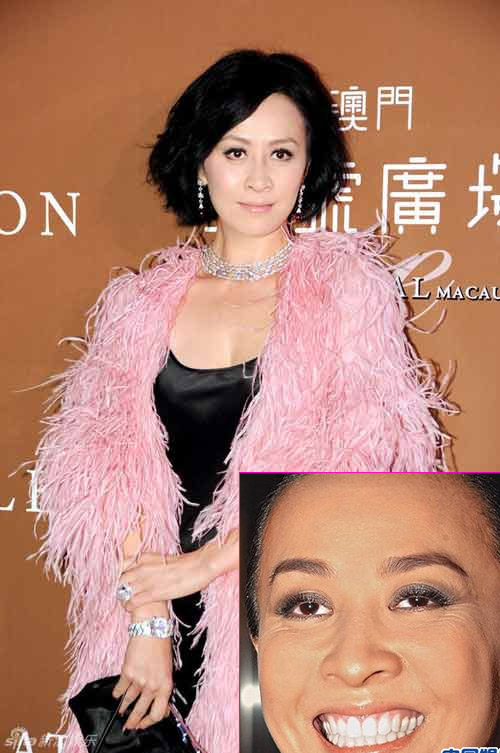 Góc ảnh xấu "để đời" của sao - 10