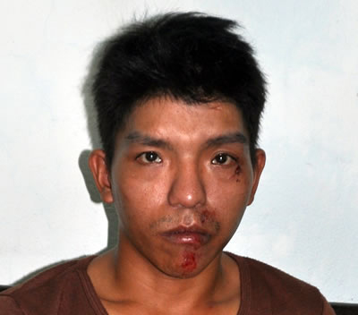 Cảnh giác với cướp giật, trộm cắp - 2