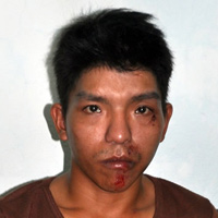 Tin Đà Nẵng - Cảnh giác với cướp giật, trộm cắp