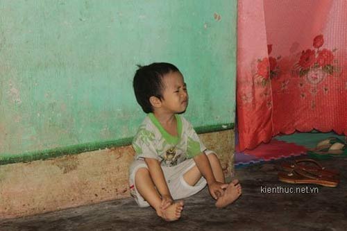 Bệnh lạ: Thiếu nữ 22 tuổi như trẻ lên 3 - 3
