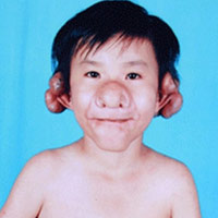 Phi thường - kỳ quặc - Cậu bé mang khuôn mặt "Trư Bát Giới"