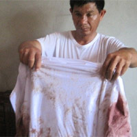 Pháp luật - 20 côn đồ hành hung cả nhà phải nhập viện